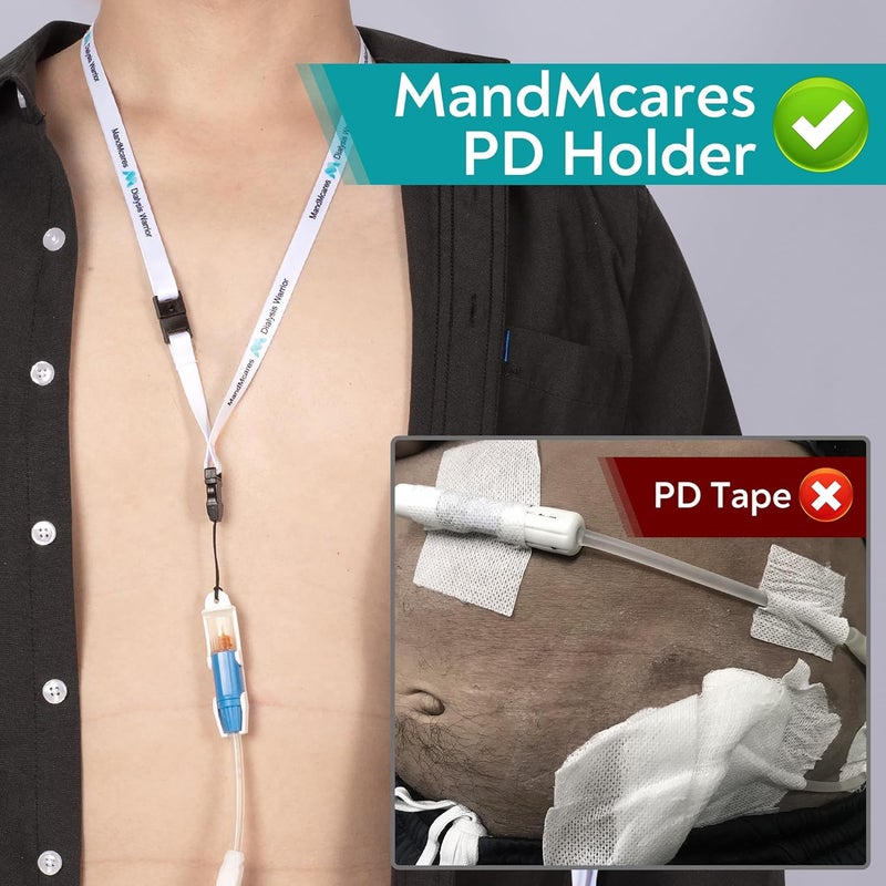 MandMcares حامل مجموعة نقل قسطرة الغسيل الكلوي البريتوني الأصغر. ملحقات دش PD Secure. 2 حبال عنق قابلة للتعديل مع ميزة الانفصال للسلامة. (أبيض) - Image 4